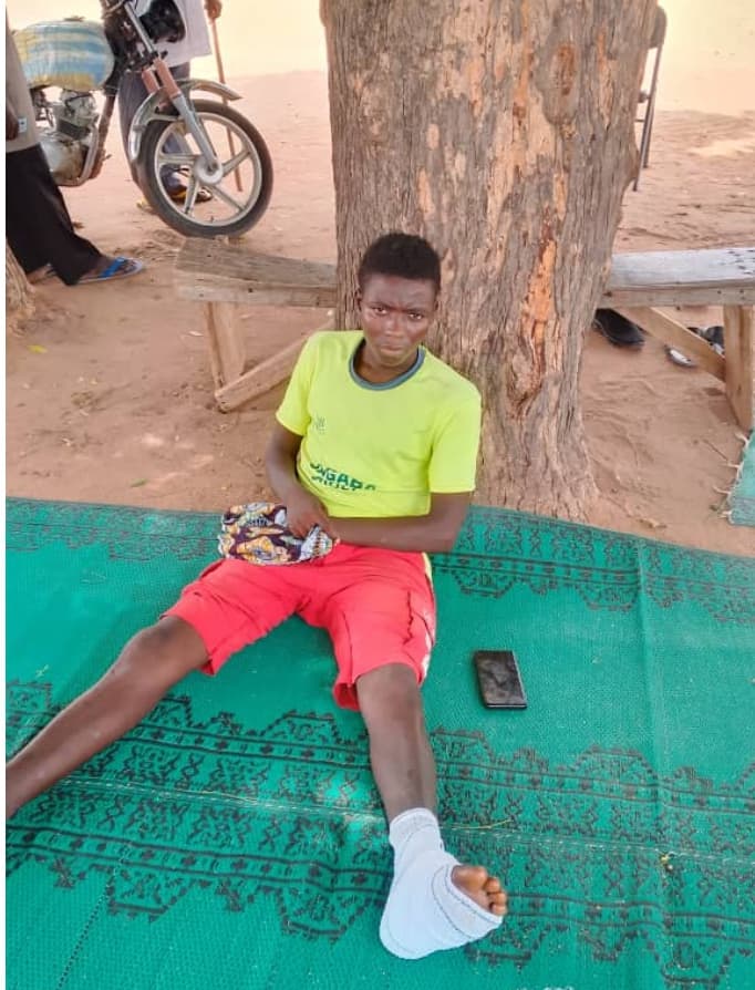 Strange Flesh Eating Disease Strikes Adamawa Community